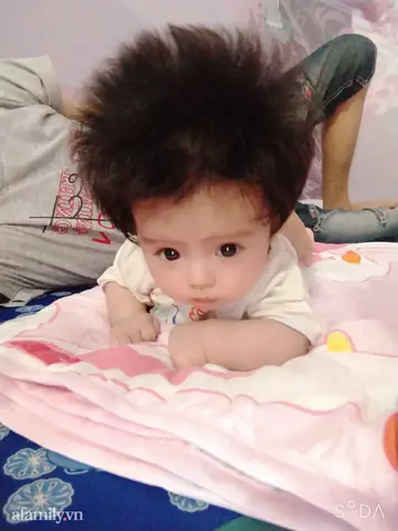 Tóc Bé Bị Dựng Ngược: Nguyên Nhân, Cách Khắc Phục Hiệu Quả & Lời Khuyên Từ Chuyên Gia