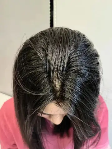 Khắc Phục Tóc Bết Dính Sau Khi Gội: Nguyên Nhân Và Giải Pháp Hiệu Quả Khắc Phục Tóc Bết Dính Sau Khi Gội: Nguyên Nhân Và Giải Pháp Hiệu Quả