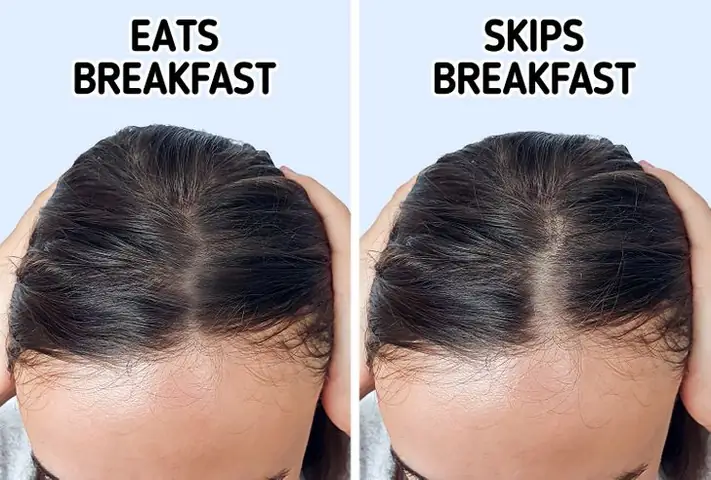 Tóc Mỏng Dần: Nguyên Nhân Sâu Xa, Giải Pháp Toàn Diện Và Cách Phục Hồi Hiệu Quả Tóc Mỏng Dần: Nguyên Nhân Sâu Xa, Giải Pháp Toàn Diện Và Cách Phục Hồi Hiệu Quả
