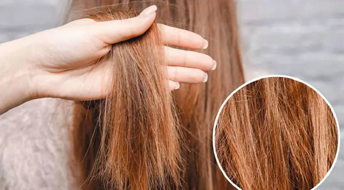 Tóc Cháy Nắng Có Màu Gì? Dấu Hiệu & Cách Phục Hồi Hiệu Quả
