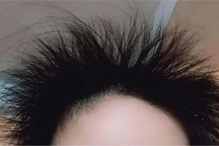Tóc Con Mọc Lởm Chởm: Nguyên Nhân, Cách Khắc Phục Và Bí Quyết Giúp Tóc Vào Nếp