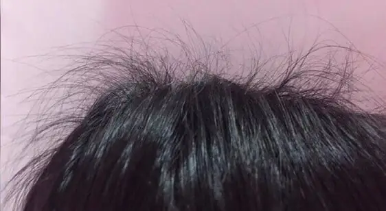 Tóc Con Mọc Nhiều Phải Làm Sao? Cách Xử Lý Hiệu Quả Tóc Con Mọc Lởm Chởm