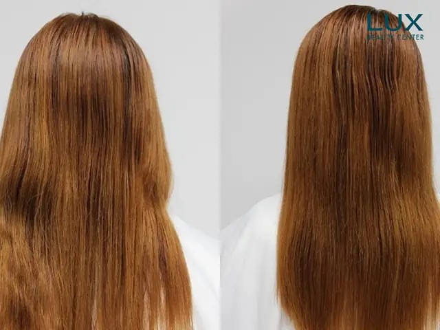 Khắc Phục Tóc Khô Xơ, Rụng Nhiều: Nguyên Nhân & Giải Pháp Toàn Diện Khắc Phục Tóc Khô Xơ, Rụng Nhiều: Nguyên Nhân & Giải Pháp Toàn Diện