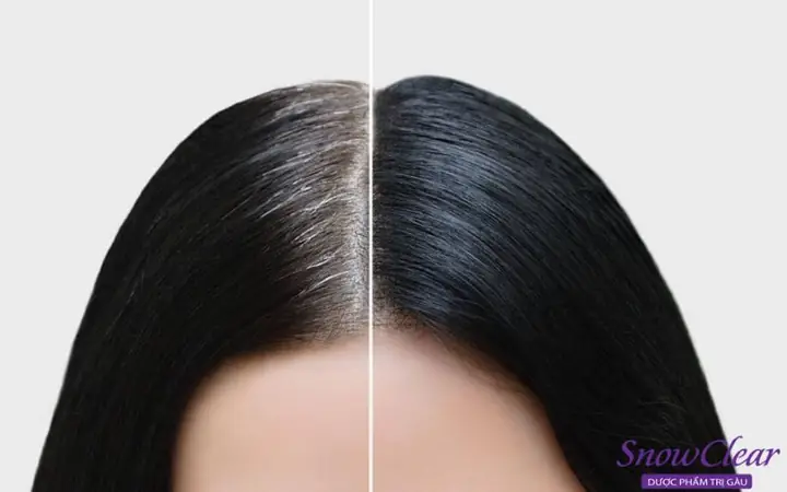 Khắc Phục Tóc Nhuộm Đen Quá Đậm: Bí Quyết Tẩy Màu An Toàn Tại Nhà