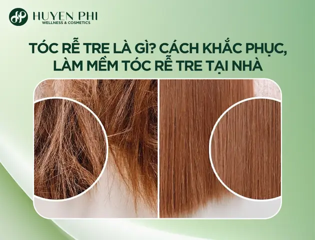Tóc Rễ Tre Có Khổ Không? Nguyên Nhân, Đặc Điểm Và Cách Khắc Phục Hiệu Quả