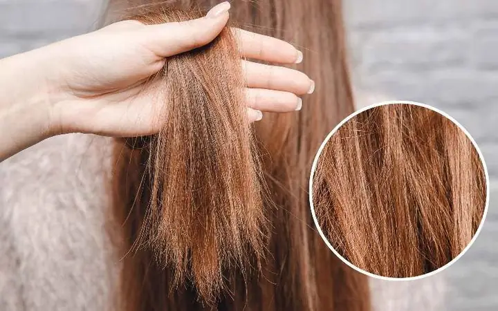 Tóc Rễ Tre Là Gì? Nguyên Nhân, Dấu Hiệu Và Cách Chăm Sóc Hiệu Quả Tóc Rễ Tre Là Gì? Nguyên Nhân, Dấu Hiệu Và Cách Chăm Sóc Hiệu Quả