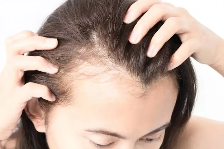 Tóc Rụng Nhiều Phải Làm Sao? Nguyên Nhân & 10+ Cách Khắc Phục Hiệu Quả Tại Nhà