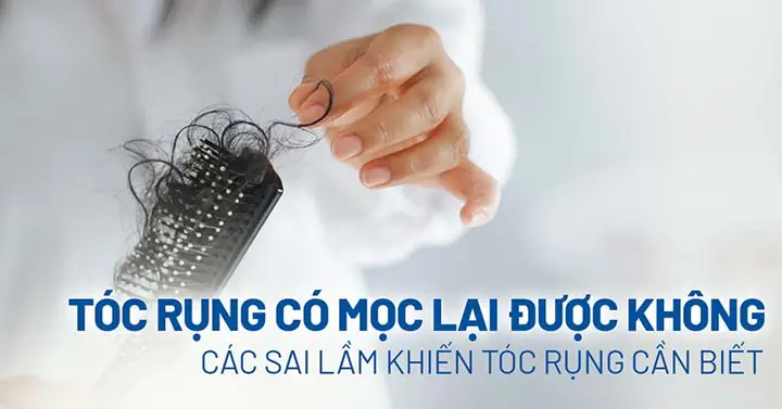 Rụng Tóc Có Mọc Lại Được Không? Giải Đáp Từ A-z Cho Mái Tóc Chắc Khỏe Rụng Tóc Có Mọc Lại Được Không? Giải Đáp Từ A-z Cho Mái Tóc Chắc Khỏe