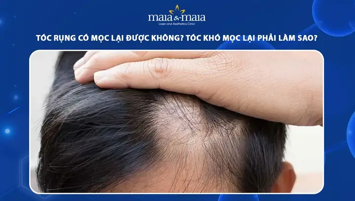 Tóc Rụng Sau Sinh Có Mọc Lại Không? Giải Đáp Toàn Diện Cho Mẹ Bỉm Sữa