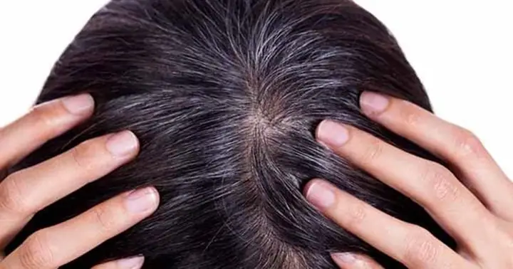 Tóc Sâu Khác Tóc Bạc Như Thế Nào? Nguyên Nhân Và Cách Xử Lý Hiệu Quả Tóc Sâu Khác Tóc Bạc Như Thế Nào? Nguyên Nhân Và Cách Xử Lý Hiệu Quả