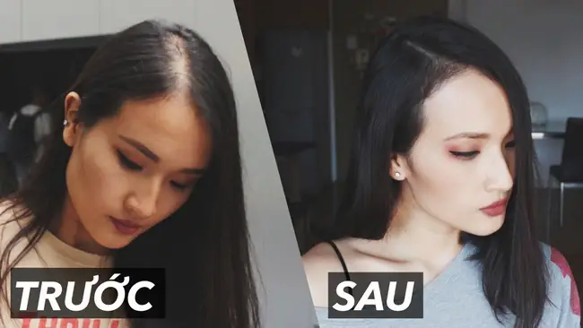 Tóc Thưa Lộ Da Đầu: Nguyên Nhân, Cách Nhận Biết Và Giải Pháp Cải Thiện Hiệu Quả Tóc Thưa Lộ Da Đầu: Nguyên Nhân, Cách Nhận Biết Và Giải Pháp Cải Thiện Hiệu Quả