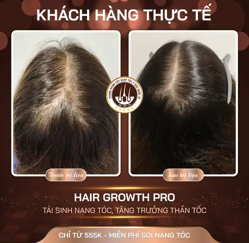 Tóc Và Lông Mày Có Tác Dụng Gì: Chức Năng Bảo Vệ, Thẩm Mỹ Và Biểu Cảm
