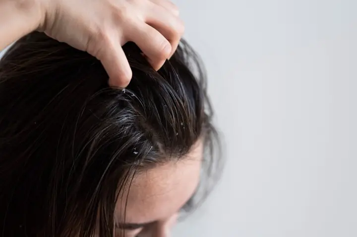 Tóc Vuốt Nhẹ Cũng Rụng Cả Nắm: Nguyên Nhân Và Cách Khắc Phục Hiệu Quả Tóc Vuốt Nhẹ Cũng Rụng Cả Nắm: Nguyên Nhân Và Cách Khắc Phục Hiệu Quả
