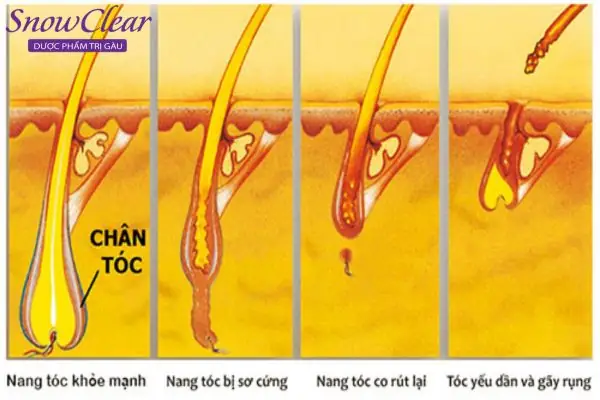 Tóc Yếu Là Tóc Như Thế Nào? Dấu Hiệu Nhận Biết Và Cách Phục Hồi Hiệu Quả