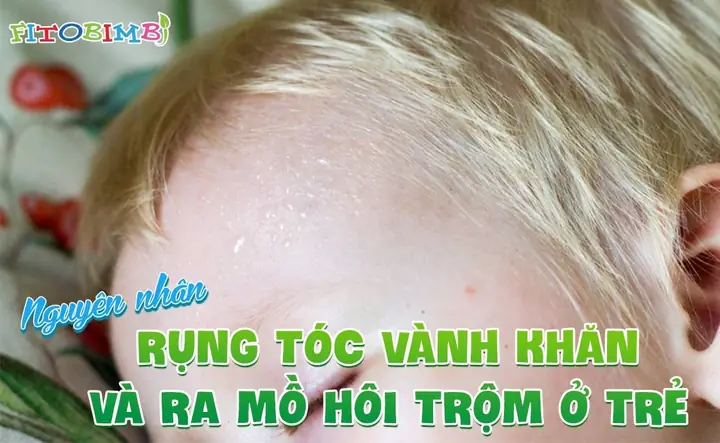 Trẻ Rụng Tóc Vành Khăn Kèm Ra Mồ Hôi Trộm: Dấu Hiệu Còi Xương Hay Thiếu Chất? Trẻ Rụng Tóc Vành Khăn Kèm Ra Mồ Hôi Trộm: Dấu Hiệu Còi Xương Hay Thiếu Chất?