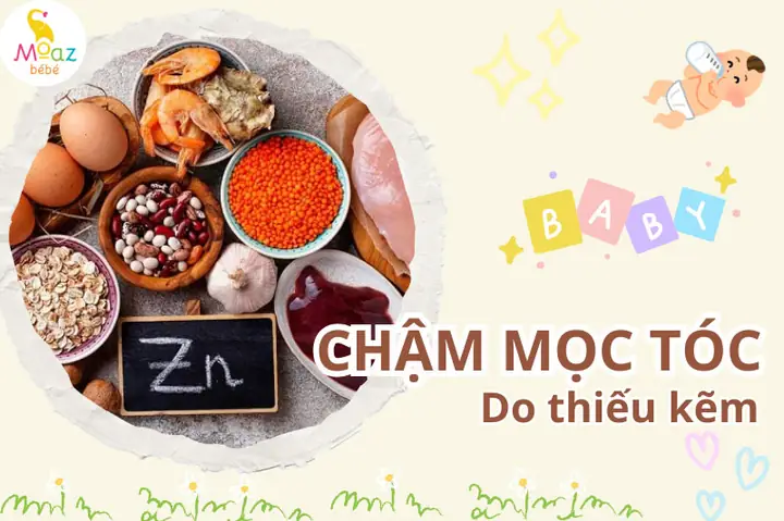 Trẻ Chậm Mọc Tóc Thiếu Chất Gì? Nguyên Nhân & Cách Bổ Sung Hiệu Quả Cho Bé Trẻ Chậm Mọc Tóc Thiếu Chất Gì? Nguyên Nhân & Cách Bổ Sung Hiệu Quả Cho Bé