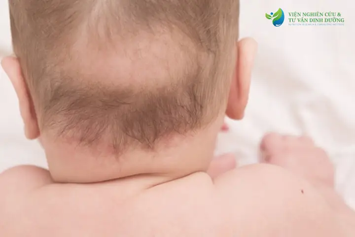 Trẻ Sơ Sinh Bị Rụng Tóc: Nguyên Nhân, Cách Khắc Phục & Khi Nào Cần Lo Lắng