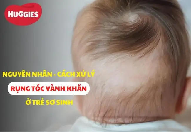 Trẻ Sơ Sinh Bị Rụng Tóc: Bệnh Gì Hay Là Hiện Tượng Sinh Lý Bình Thường? Trẻ Sơ Sinh Bị Rụng Tóc: Bệnh Gì Hay Là Hiện Tượng Sinh Lý Bình Thường?
