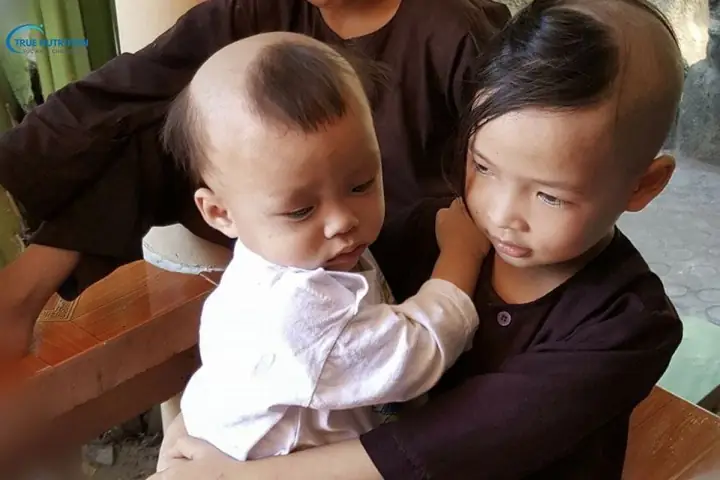 Bé Sơ Sinh Mọc Tóc Ba Chỏm: Ý Nghĩa, Nguyên Nhân & Cách Chăm Sóc Tóc