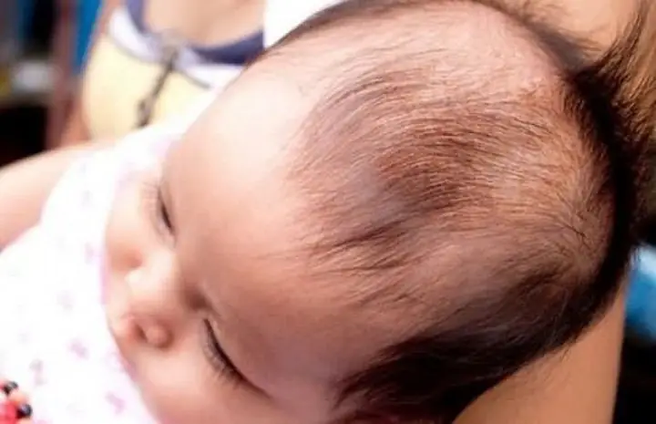 Bé Sơ Sinh Mọc Tóc Ba Chỏm: Ý Nghĩa, Nguyên Nhân & Cách Chăm Sóc Tóc