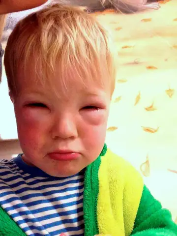 Trẻ Sơ Sinh Ngửi Mùi Thuốc Nhuộm Tóc: Nguy Cơ Tiềm Ẩn Và Cách Bảo Vệ Bé Trẻ Sơ Sinh Ngửi Mùi Thuốc Nhuộm Tóc: Nguy Cơ Tiềm Ẩn Và Cách Bảo Vệ Bé
