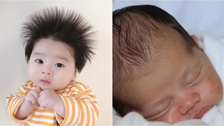 Tóc Trẻ Sơ Sinh Dựng Ngược: Nguyên Nhân, Cách Khắc Phục Và Khi Nào Cần Lo Lắng Tóc Trẻ Sơ Sinh Dựng Ngược: Nguyên Nhân, Cách Khắc Phục Và Khi Nào Cần Lo Lắng