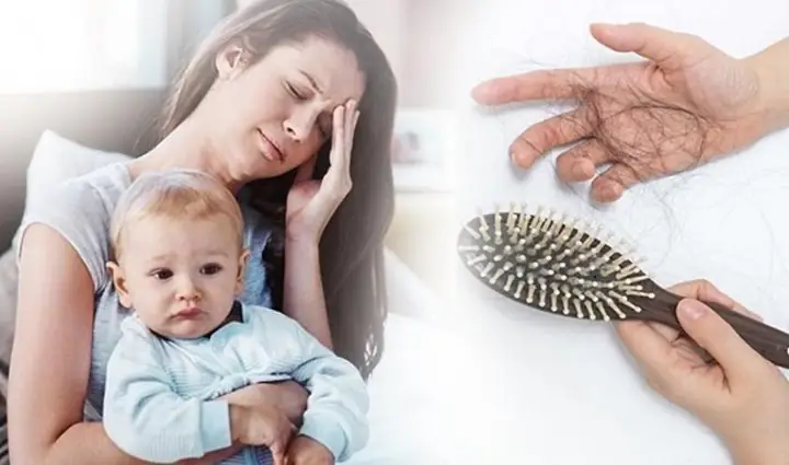 Trị Gàu & Rụng Tóc Sau Sinh: Bí Quyết Phục Hồi Tóc Chắc Khỏe Cho Mẹ Bỉm