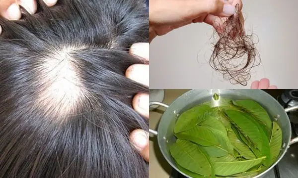 9+ Cách Trị Rụng Tóc Tại Nhà Hiệu Quả Từ Thiên Nhiên Giúp Tóc Chắc Khỏe