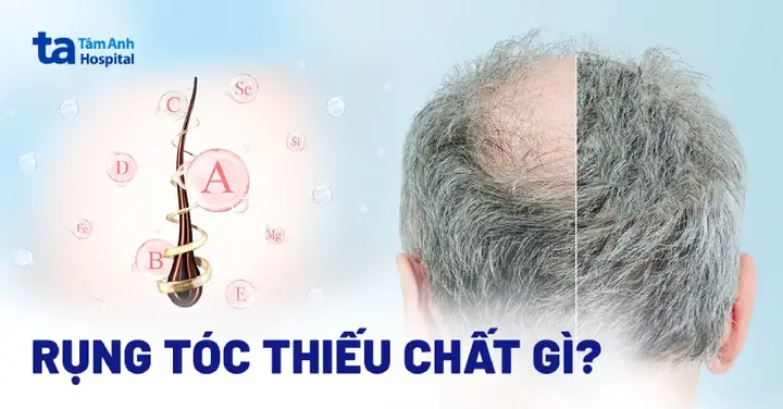 Tóc Được Cấu Tạo Từ Chất Gì: Thành Phần Chính & Dưỡng Chất Cần Thiết Cho Tóc Khỏe