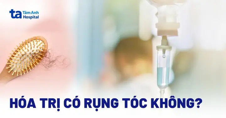 Truyền Hóa Chất Có Gây Rụng Tóc Không? Nguyên Nhân, Thời Điểm Và Cách Khắc Phục