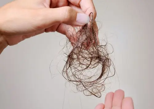 Uống Thuốc Tây Bị Rụng Tóc: Nguyên Nhân, Tác Hại Và Cách Khắc Phục Hiệu Quả Uống Thuốc Tây Bị Rụng Tóc: Nguyên Nhân, Tác Hại Và Cách Khắc Phục Hiệu Quả
