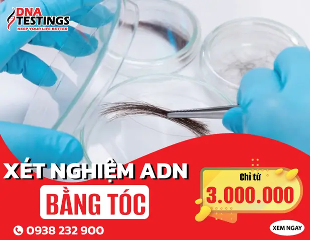 Xét Nghiệm Adn Bằng Tóc: Giá Bao Nhiêu, Độ Chính Xác & Nên Làm Ở Đâu?