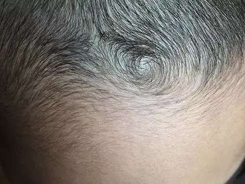 Phụ Nữ Xoáy Tóc Trước Trán: Giải Mã Tính Cách Và Vận Mệnh Theo Nhân Tướng Học Phụ Nữ Xoáy Tóc Trước Trán: Giải Mã Tính Cách Và Vận Mệnh Theo Nhân Tướng Học